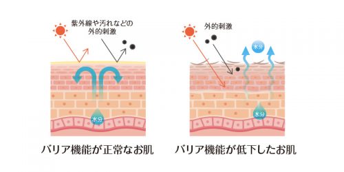 バリア機能が正常なお肌と低下したお肌